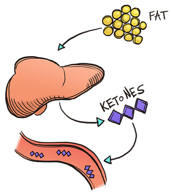 ketones 